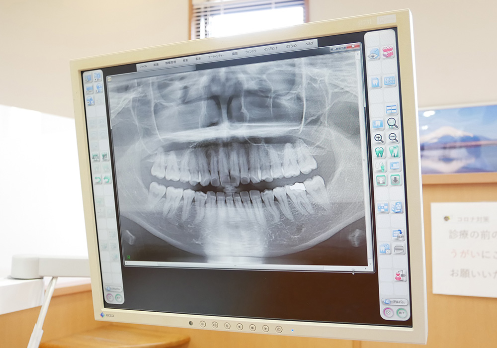 説明用モニター