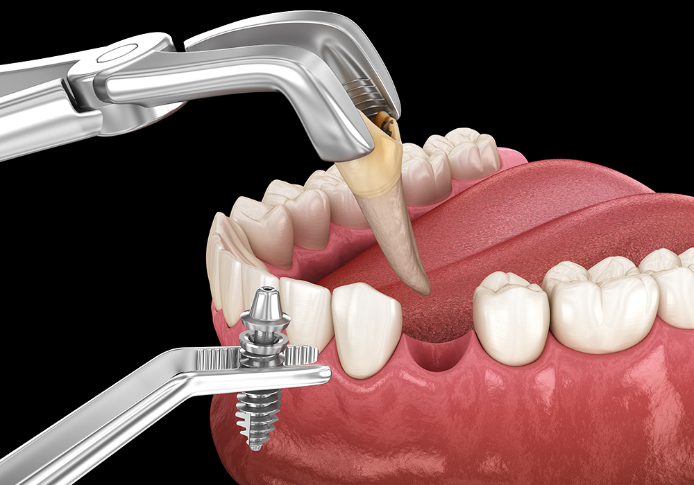 安全性の高いインプラント治療をお届けします